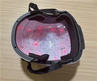 Fényterápia Alzheimer-kórban